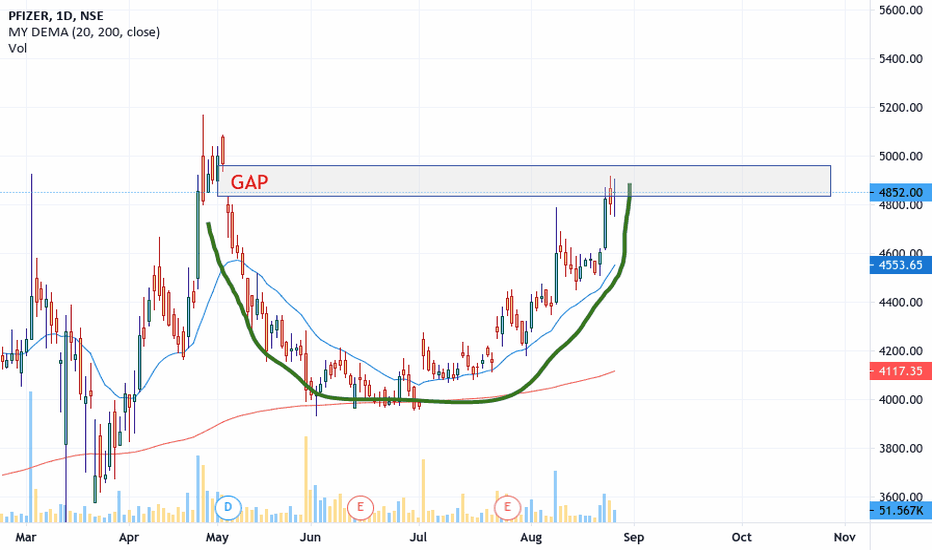 PFIZER Stock Price and Chart — NSEPFIZER — TradingView — India