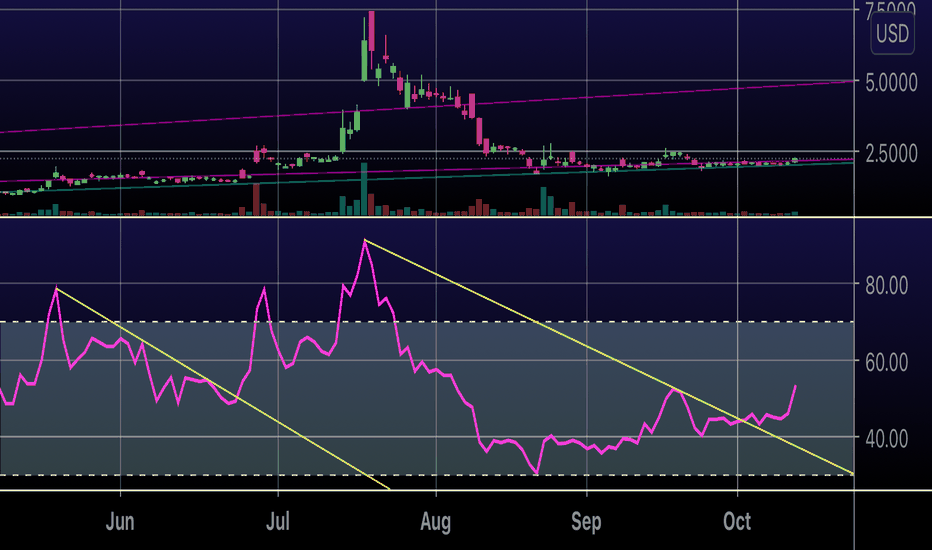 Ibio Stock Forecast What is stoploss for IBIO (Ibio Inc