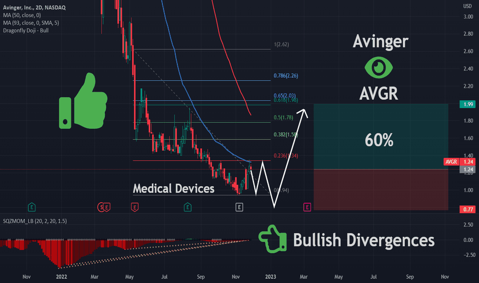 AVGR Stock Price and Chart — NASDAQAVGR — TradingView