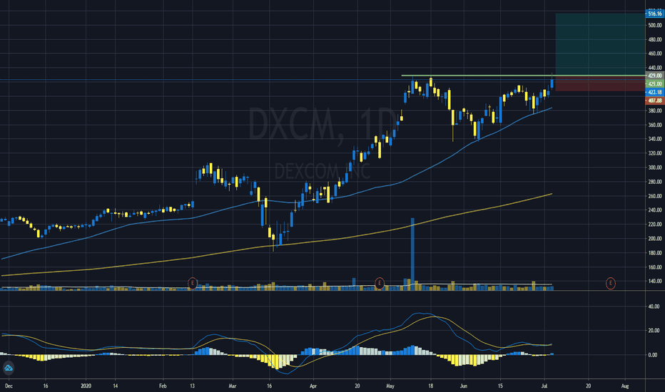 DXCM Stock Price and Chart — NASDAQDXCM — TradingView