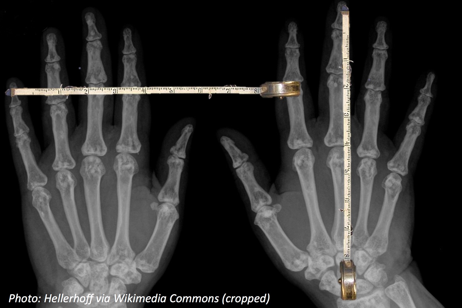 The Longest Fingers In The World