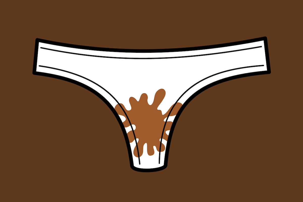 The Truth About Skid Marks and Anal Leakage