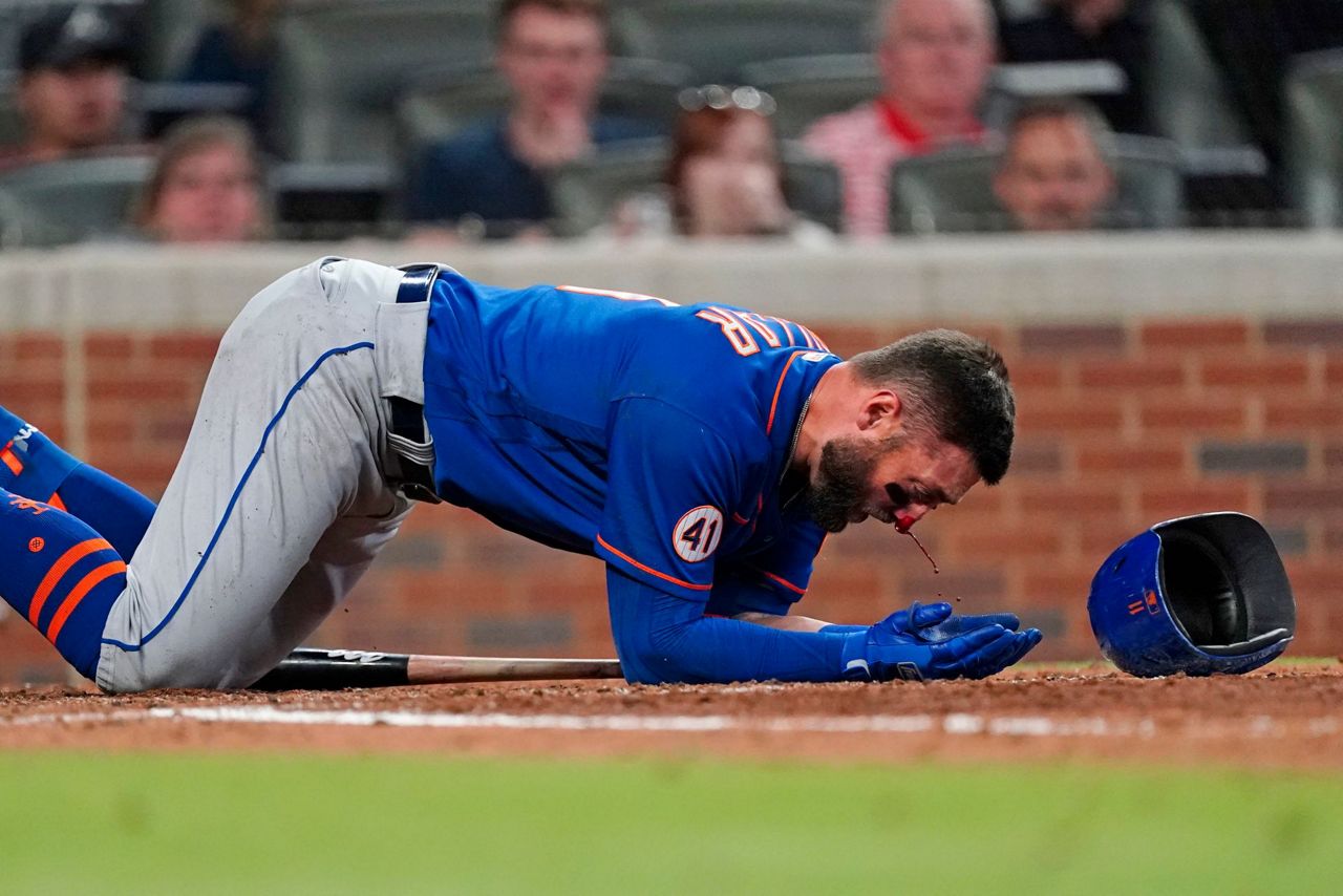 Mets' Pillar has multiple nasal fractures after hit by pitch