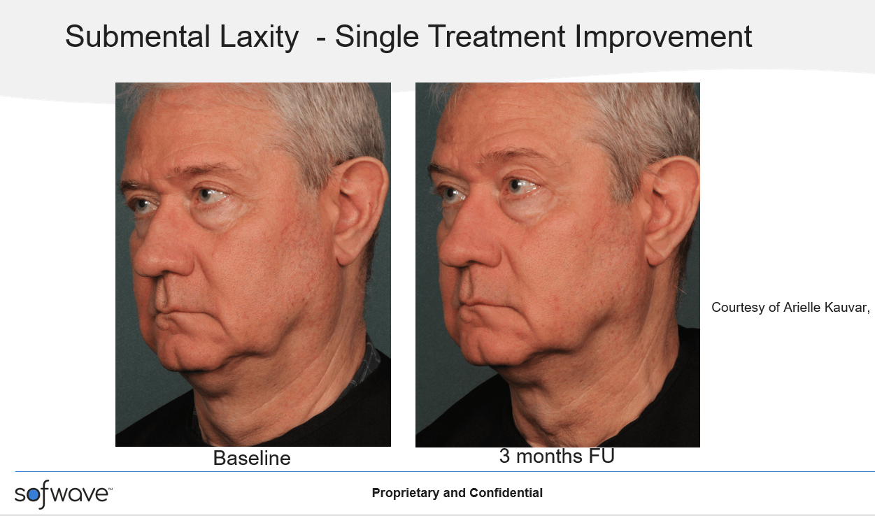 Wrinkles And Sofwave Specialist Mesa, AZ Zaina Rashid, DO, FAOCD