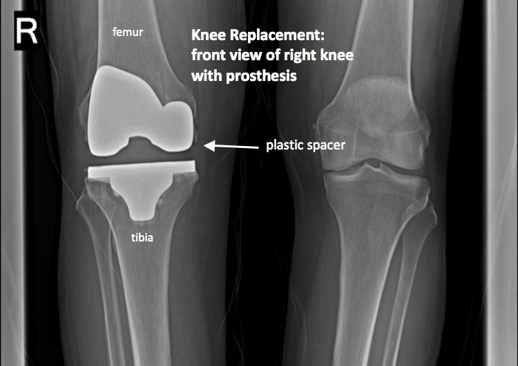 Knee Xray Century City Los Angeles, CA Commons Clinic