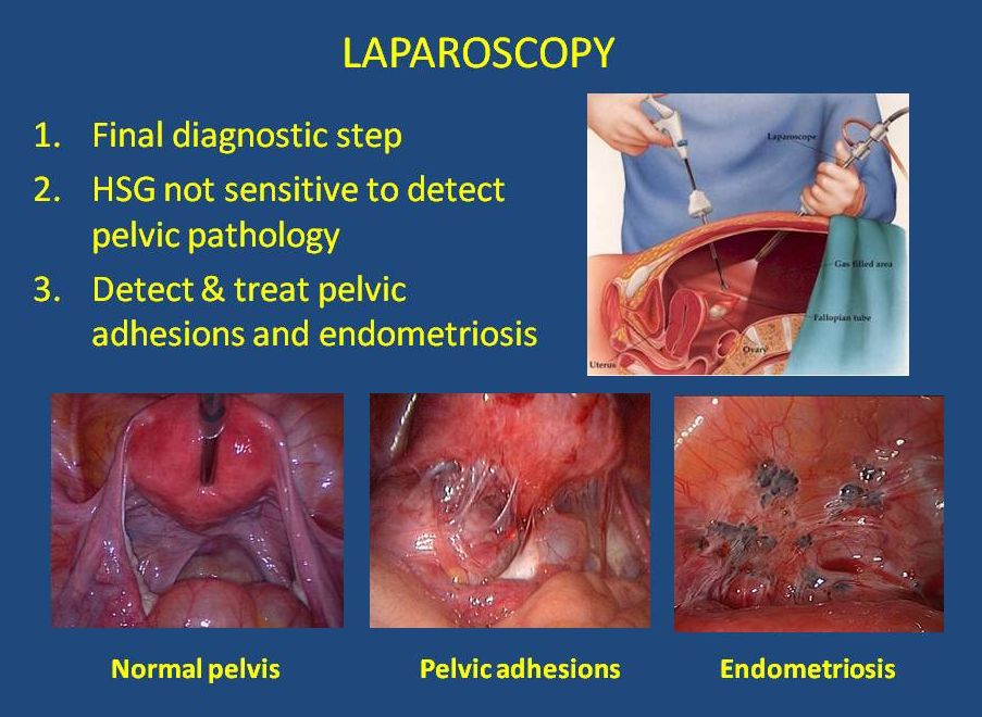 Female Diagnostic Imaging Irving, TX & Arlington, TX IVFMD