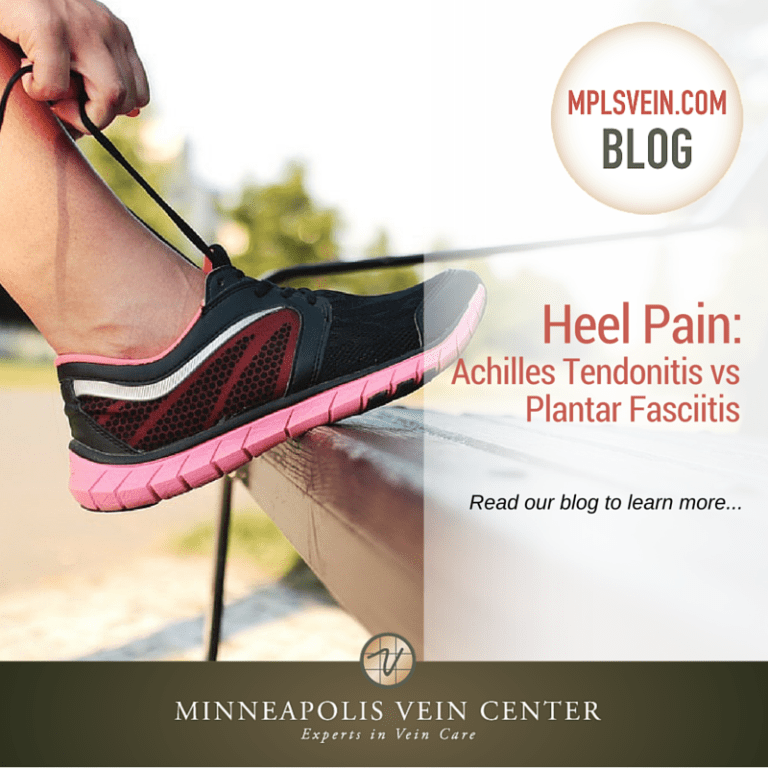 Buy > shoes for achilles tendonitis pain > in stock