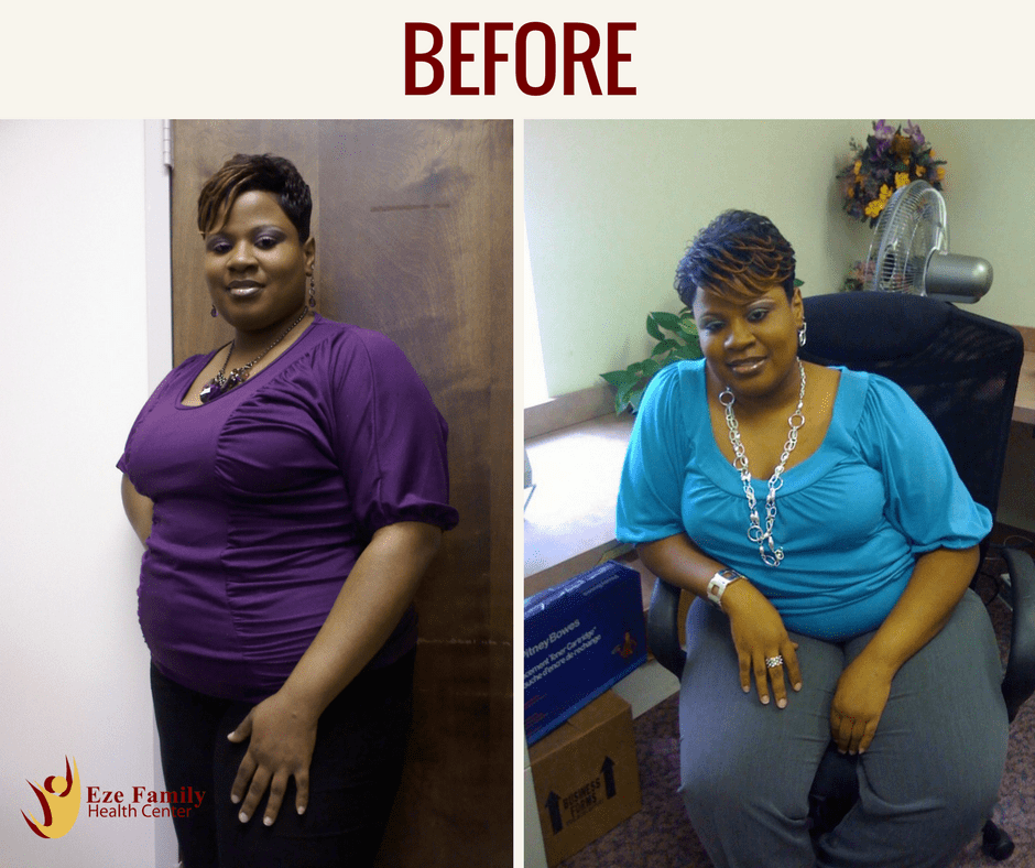 Medical Weight Loss Specialist Waldorf, MD Eze Health Center
