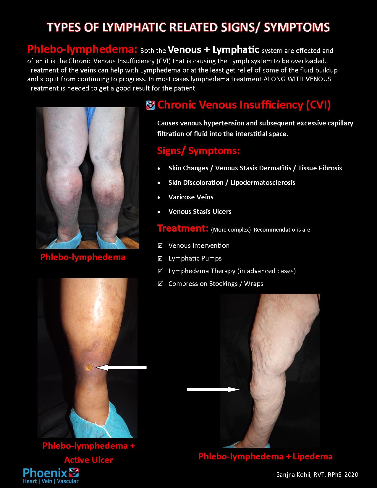 Lymphedema & Phlebolymphedema Specialists Greater Phoenix, AZ
