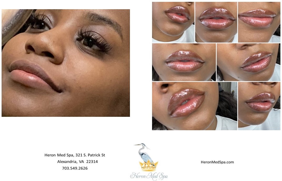 Antiaging Alexandria, VA Heron Med Spa