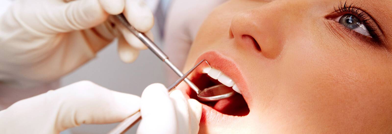 Dental Tooth Filling Cost In India Dental Filling