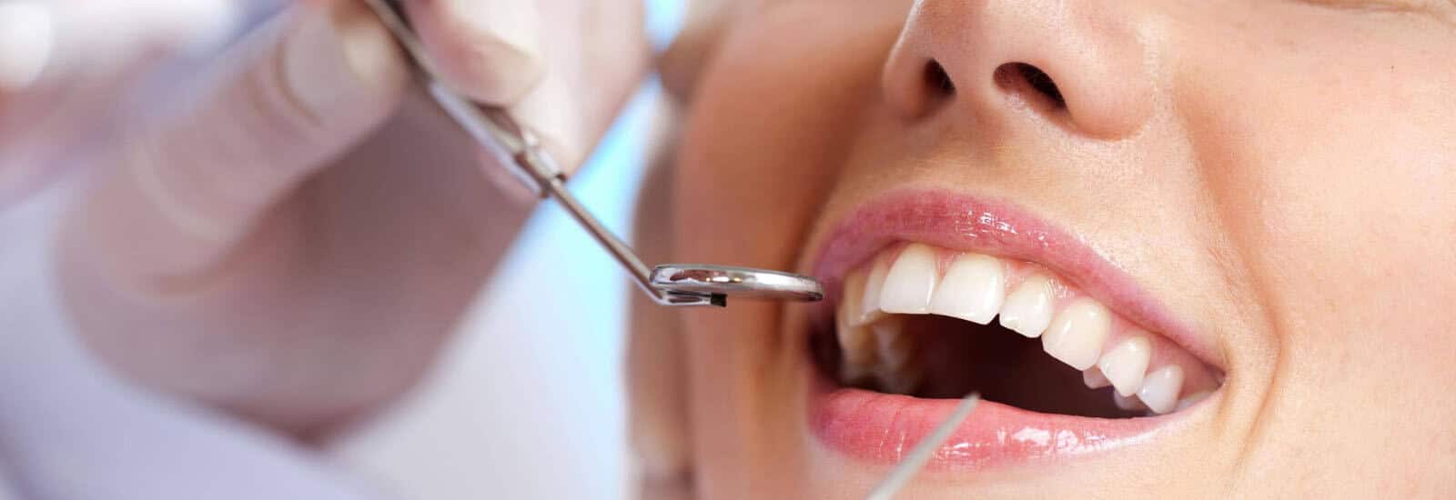 Sabka dentist dental treatment dental clinics dental health