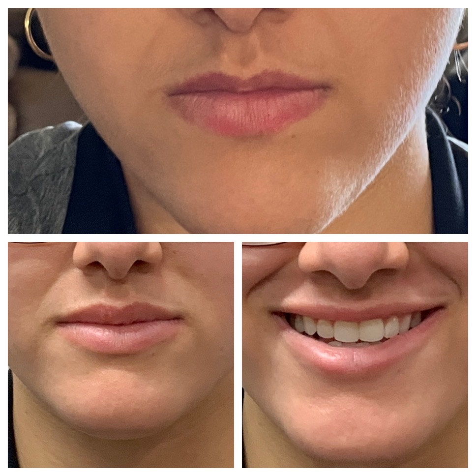 Gallery Dermatologist In Lake Forest, CA Saddleback Dermatology