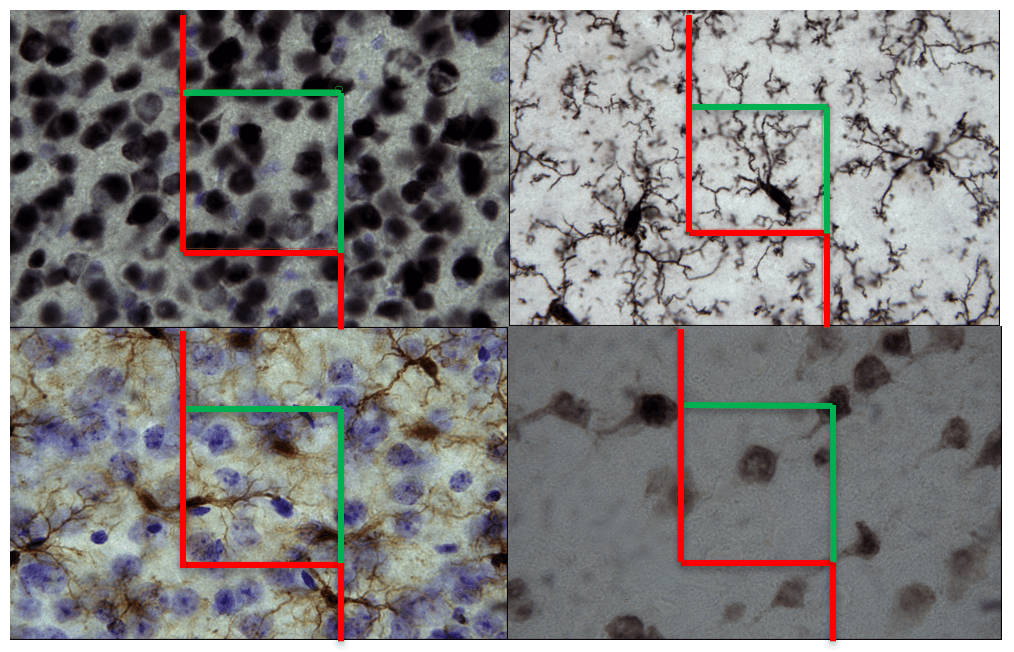 loptesilver Unbiased stereology
