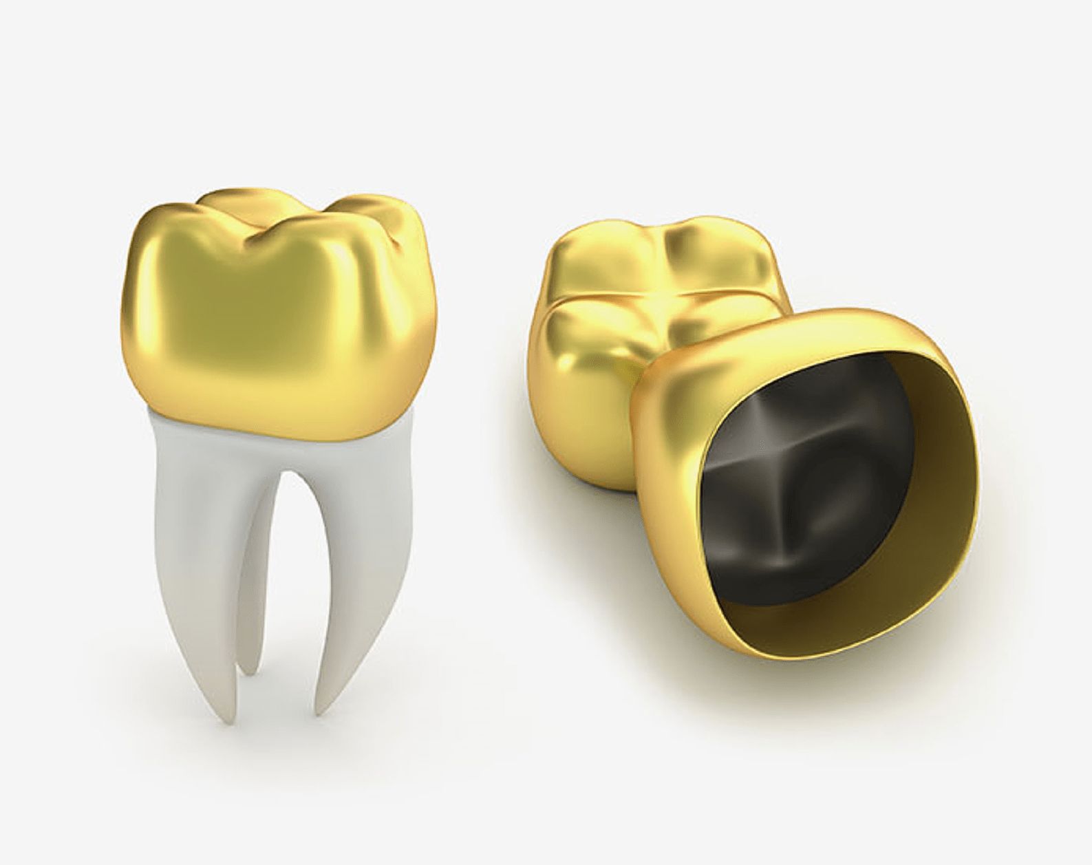 Gold Dental Crowns Safar Medical