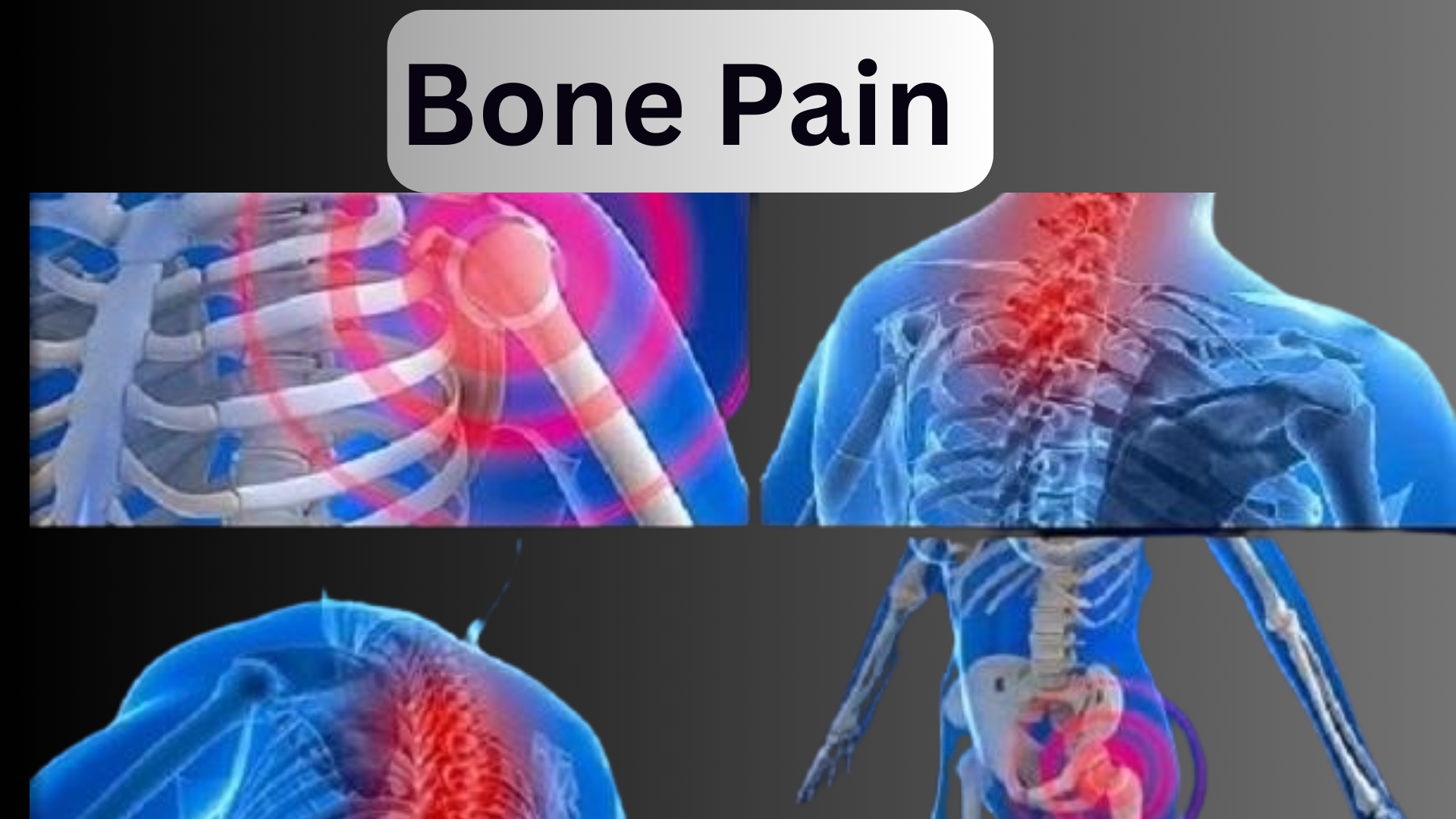 Bone Pain Cancer Symptoms, Types, Causes & Best Treatment