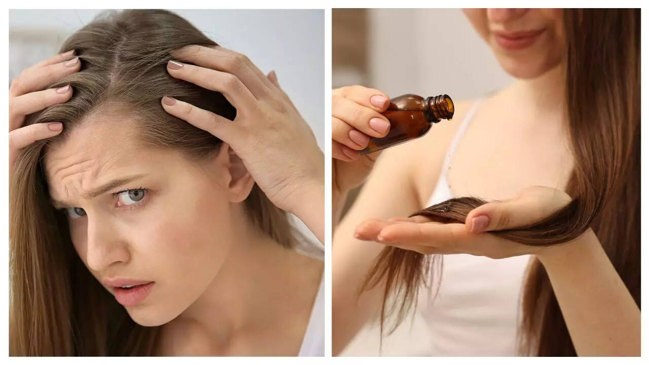Regrow hair naturally: The secret ingredient is already in your kitchen Regrow hair naturally: The secret ingredient is already in your kitchen