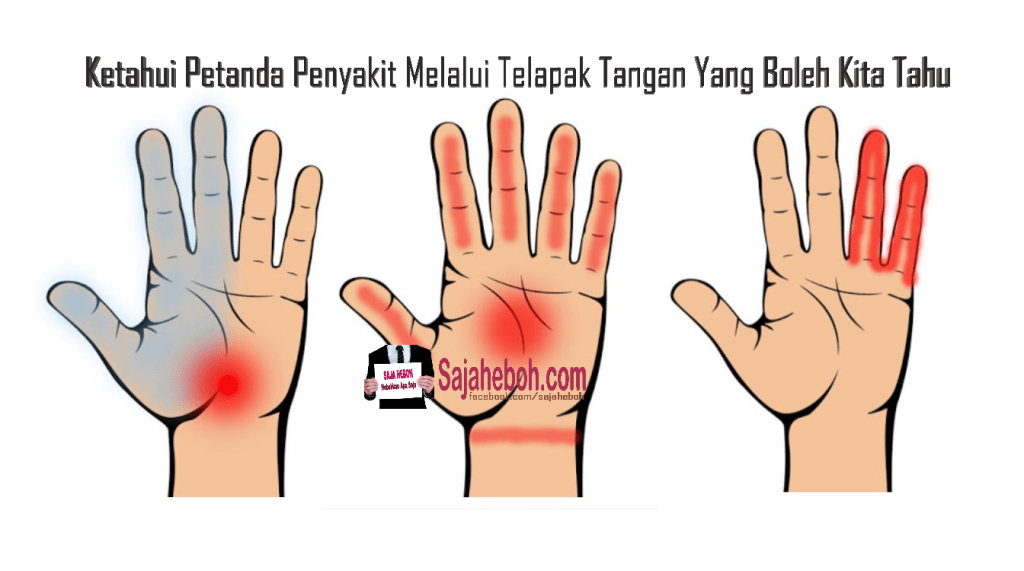 Ketahui Petanda Penyakit Melalui Telapak Tangan Yang Boleh Kita Tahu