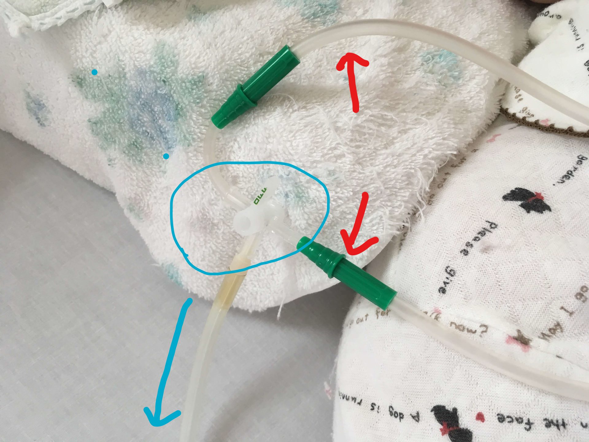 🌸低圧持続吸引器～二股式吸引法のご紹介🌸 さくらクリニック 練馬