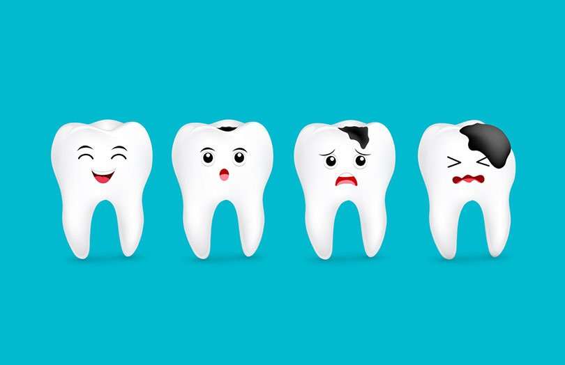 4 Common Triggers of Tooth Decay Highland Dental Group