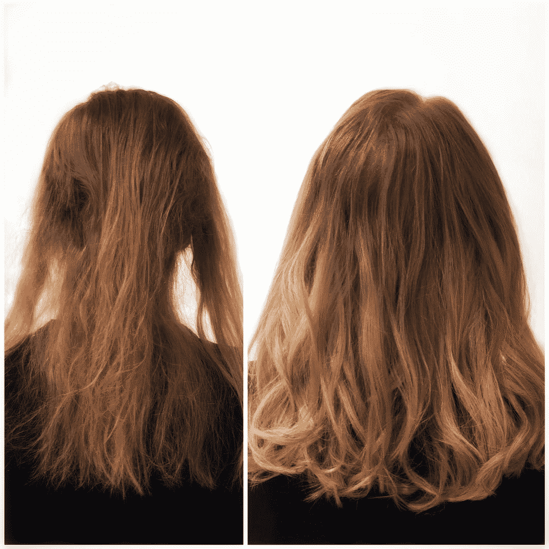 Trichotillomania Treatment Salon Ziba New York City