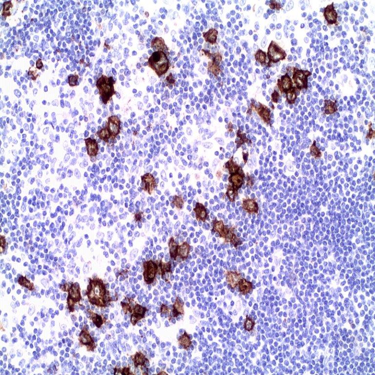 Epstein Barr Virus (EBER) CISH Detection Kit (Incl. Detection system