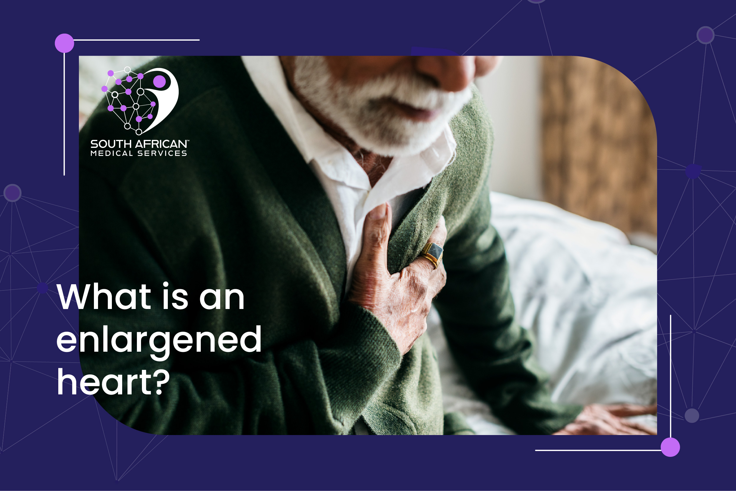 What is an enlarged heart? SA Medical Services
