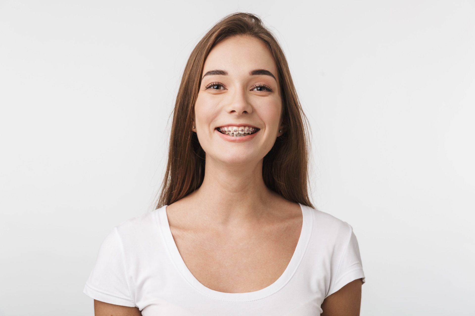 Which Type of Braces is Best for Me? San Antonio Orthodontics