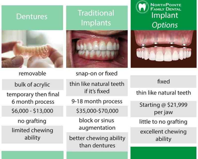 How much does a mini dental implant cost Dental News Network