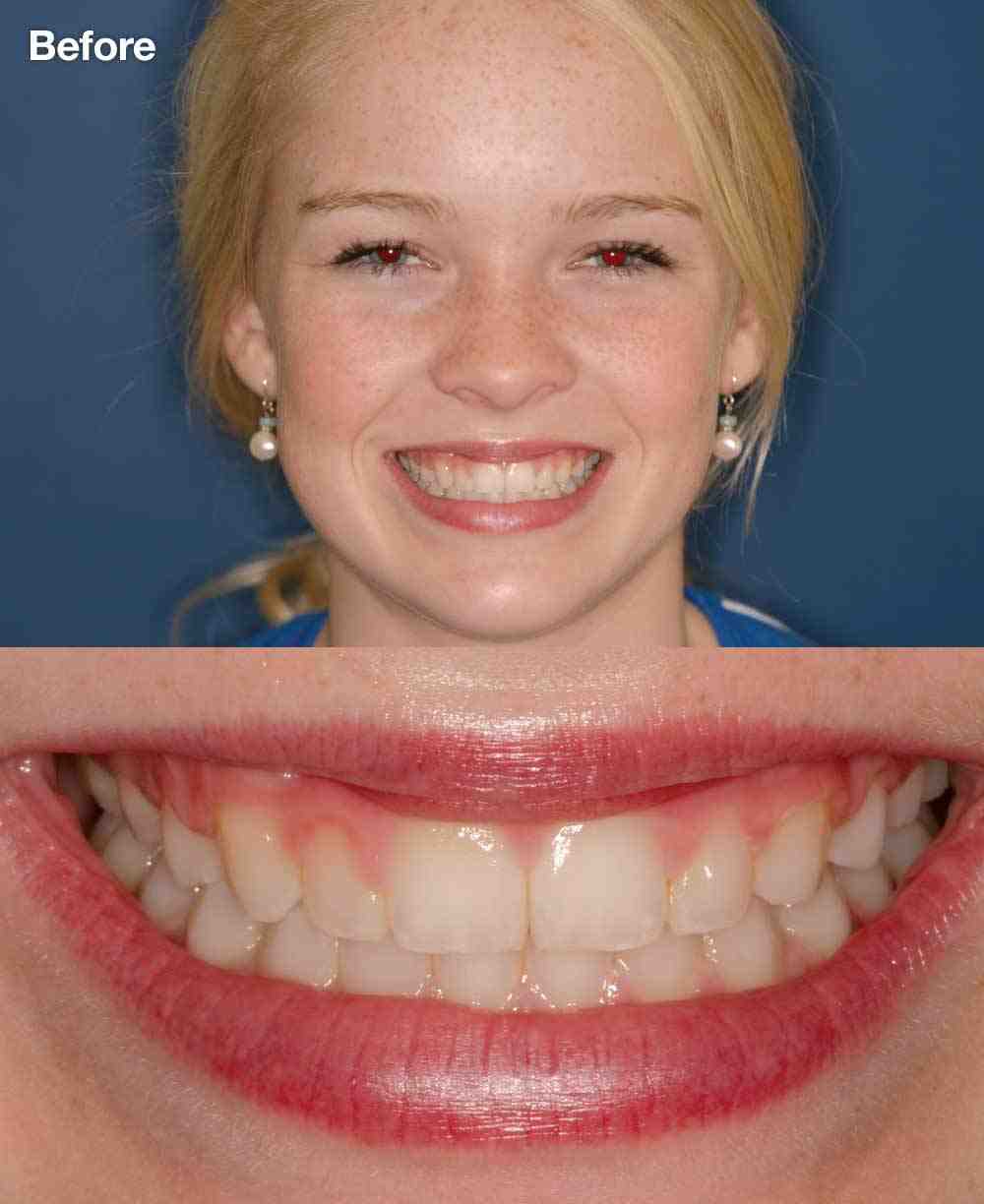 Cosmetic dentistry big front teeth Dental News Network
