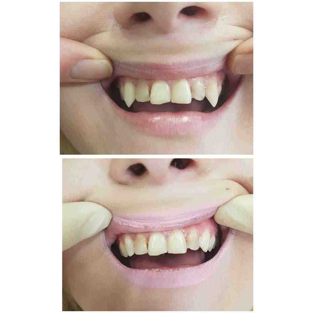 Cosmetic dentistry fang Dental News Network