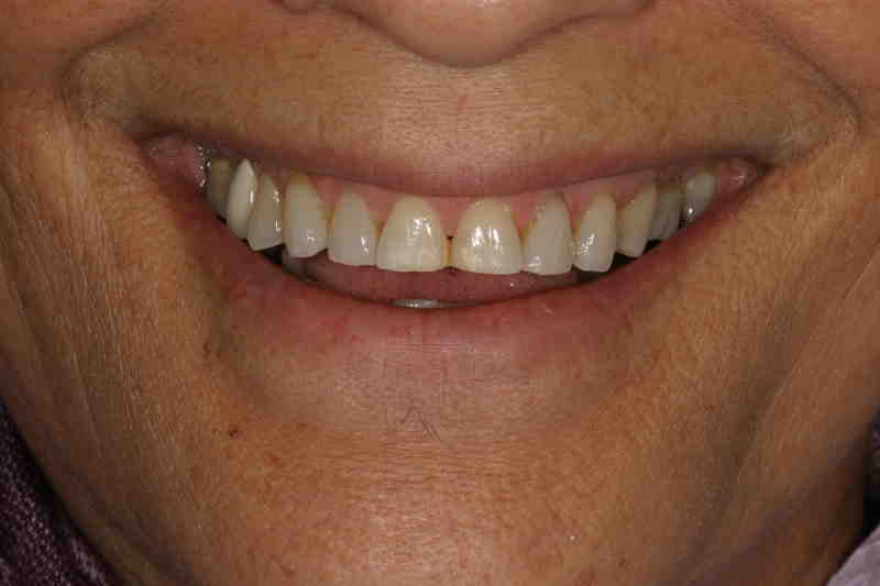 Cosmetic dentistry honolulu Dental News Network