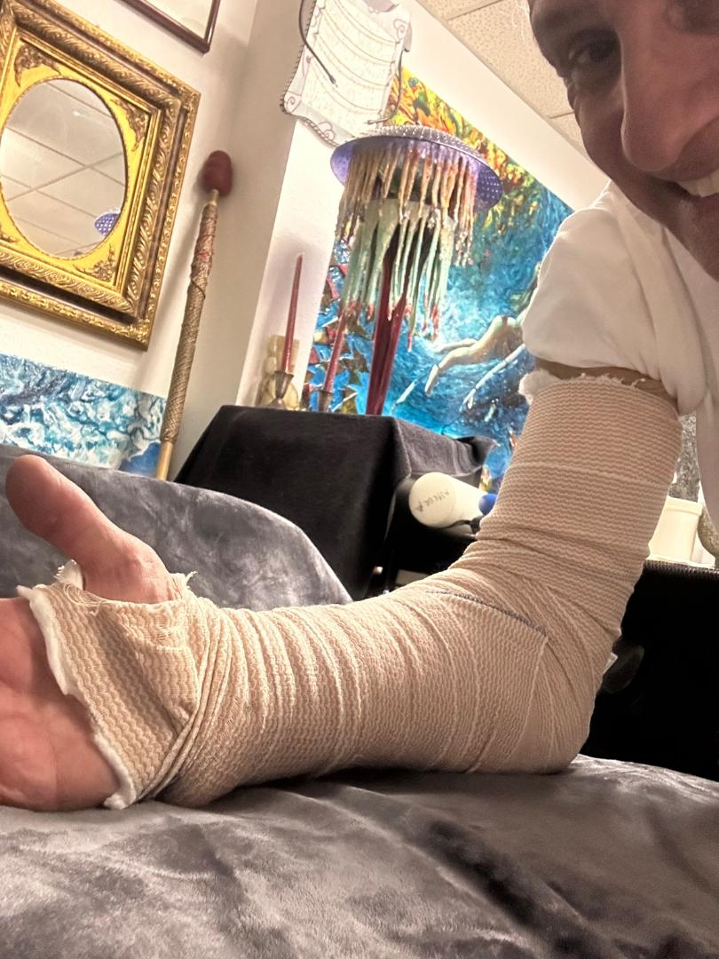 Elbow Bursitis Surgery. What does cortisone injection do to the body