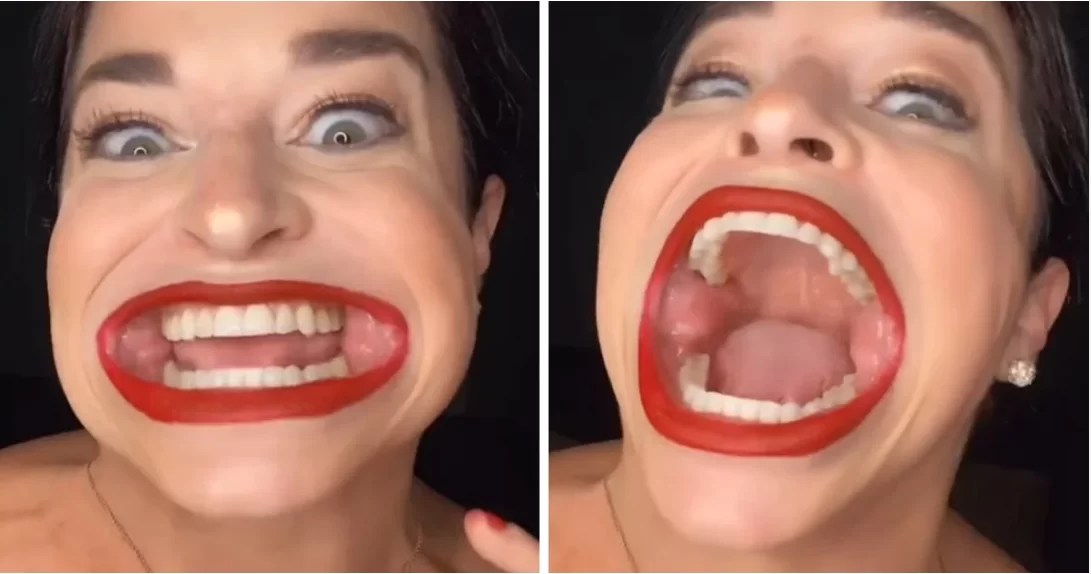 Découvrez cette femme avec la « plus grande bouche au monde » Santé
