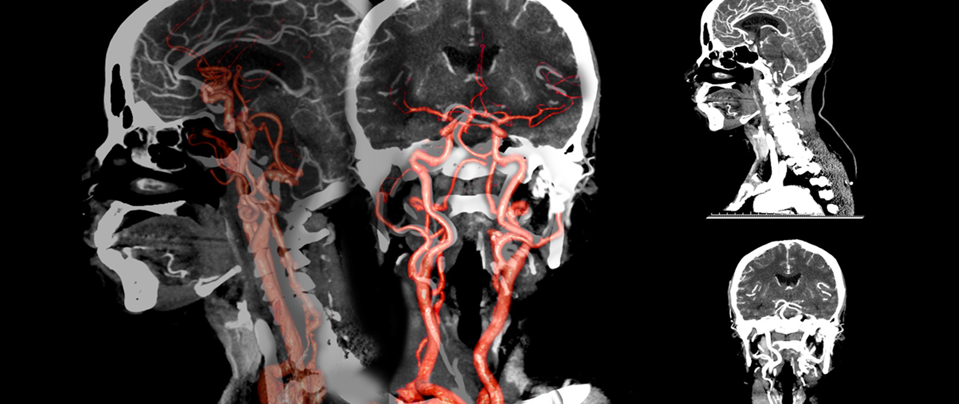 Radiology St. Augustine Private Hospital