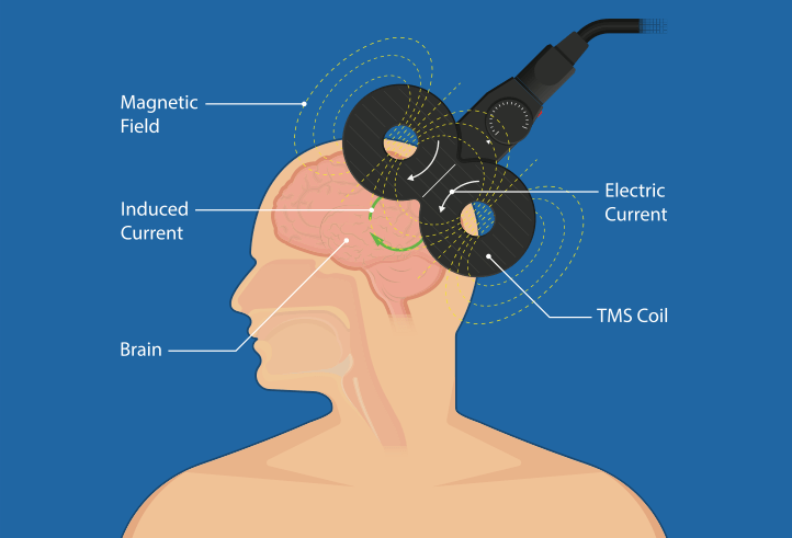 The Basics of Transcranial Stimulation Sapien Labs