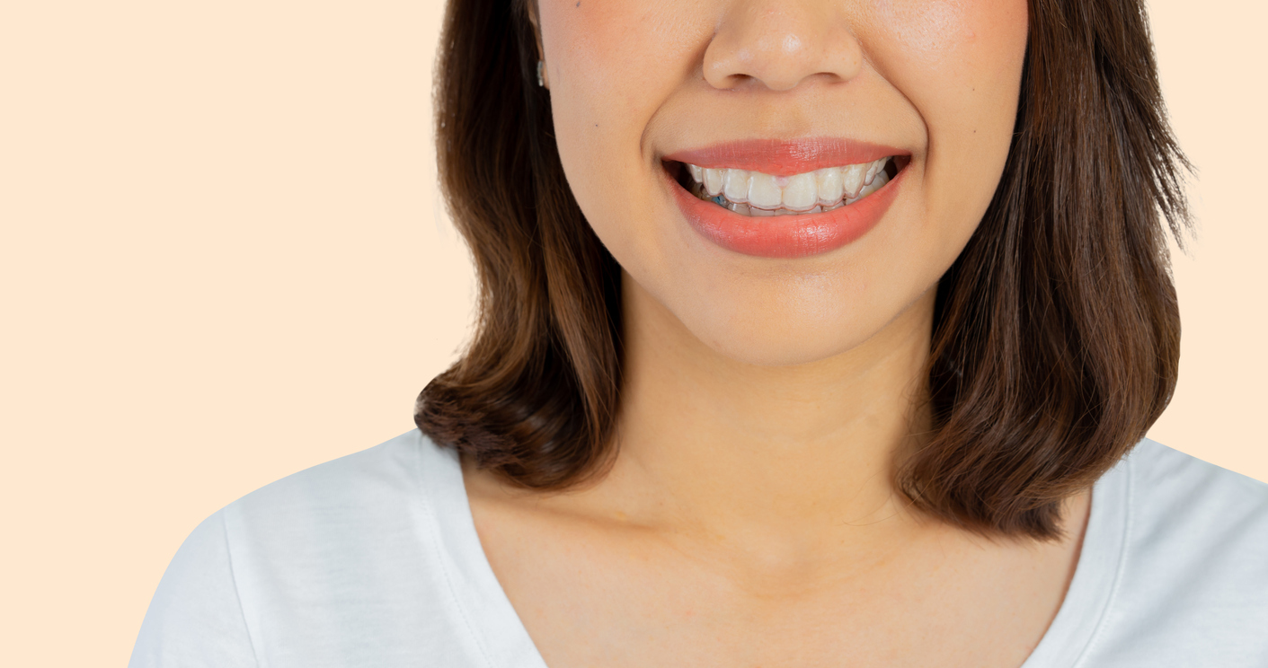 How long does orthodontic treatment typically take? Dr. Frahm