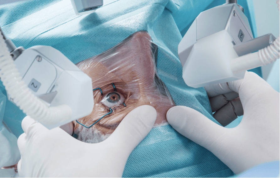 How Does Lasik Surgery Work? SaveDelete