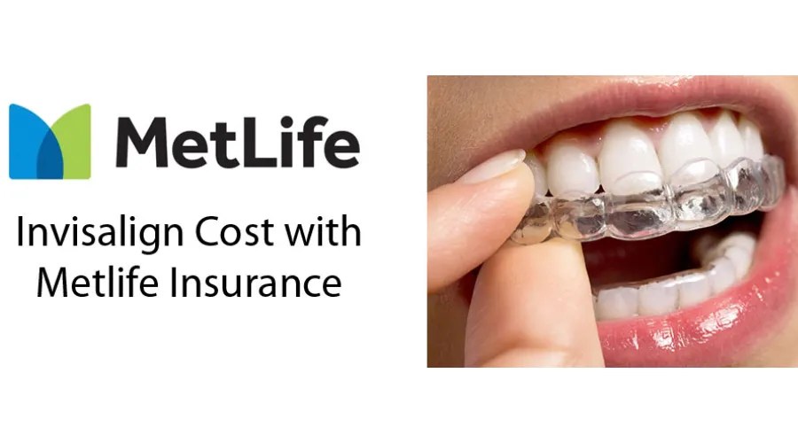 Explore Top MetLife Dental Providers For The Best Dental Care