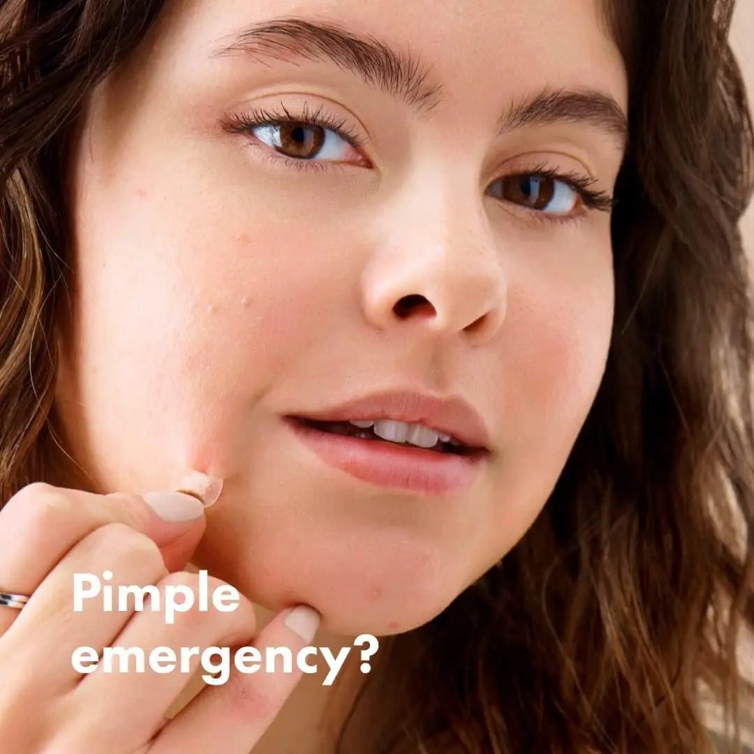 Hydro Colloid Acne Pimple Patch For Covering Zits And Blemishes Spot