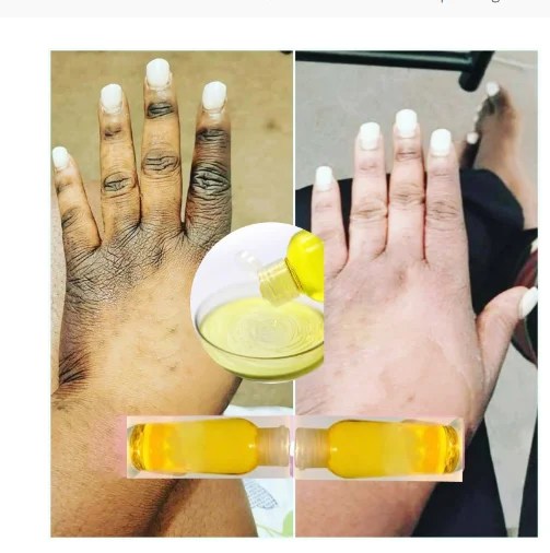 Luxury Booster Whitening Cream Peeling Skin Oil Black Skin Whitening