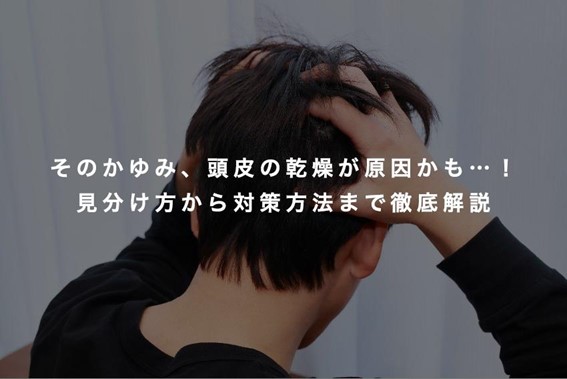 保存版】頭皮のトラブルを一気に解決！キュレルシャンプーの気になる効果と成分【Hair】 そのフケ・かゆみ、頭皮の乾燥が原因かも。乾燥を防ぐシャンプー選びのポイントは？ | スカルプD コラム | スカルプD公式サイト | アンファー