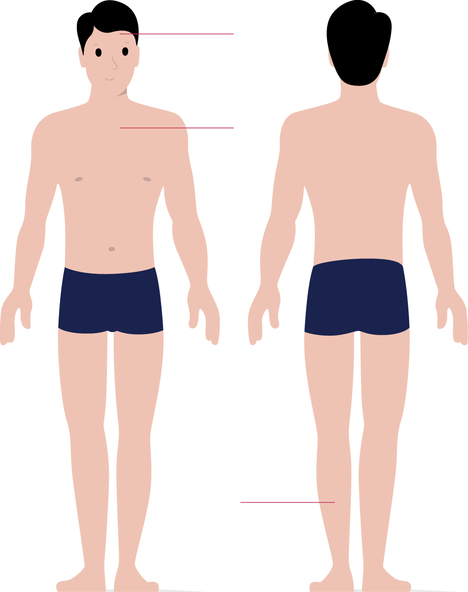 Rx Radiografie Iasi Scanexpert centru de Imagistica