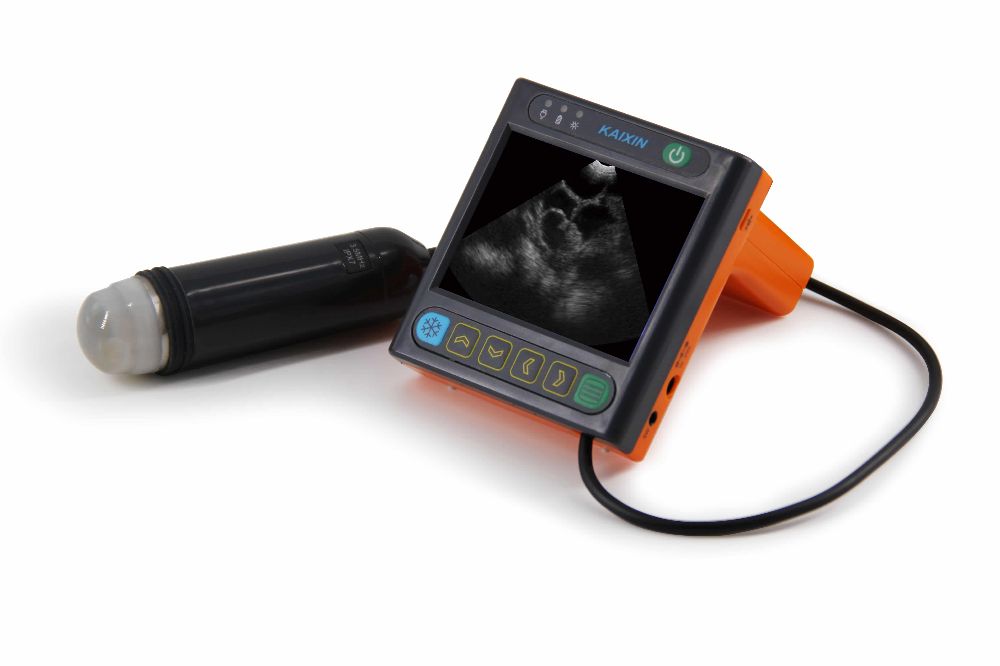 MSU 3.0 Pregnancy Scanner ScanX Ultrasound