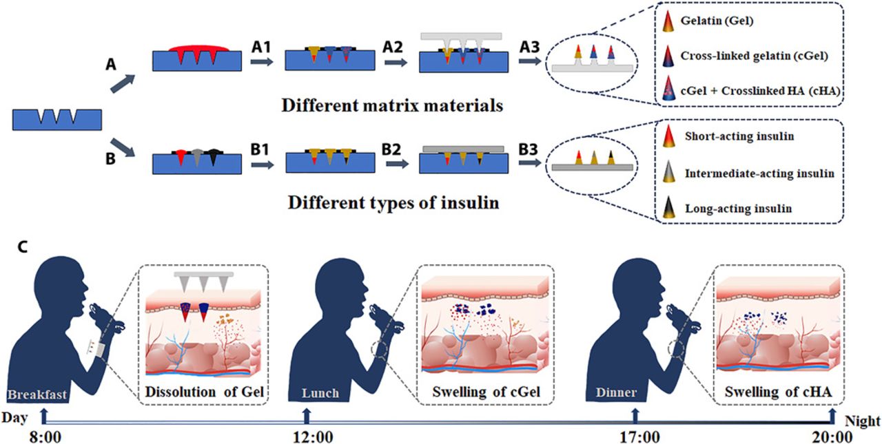 A basalbolus insulin regimen integrated microneedle patch for intraday