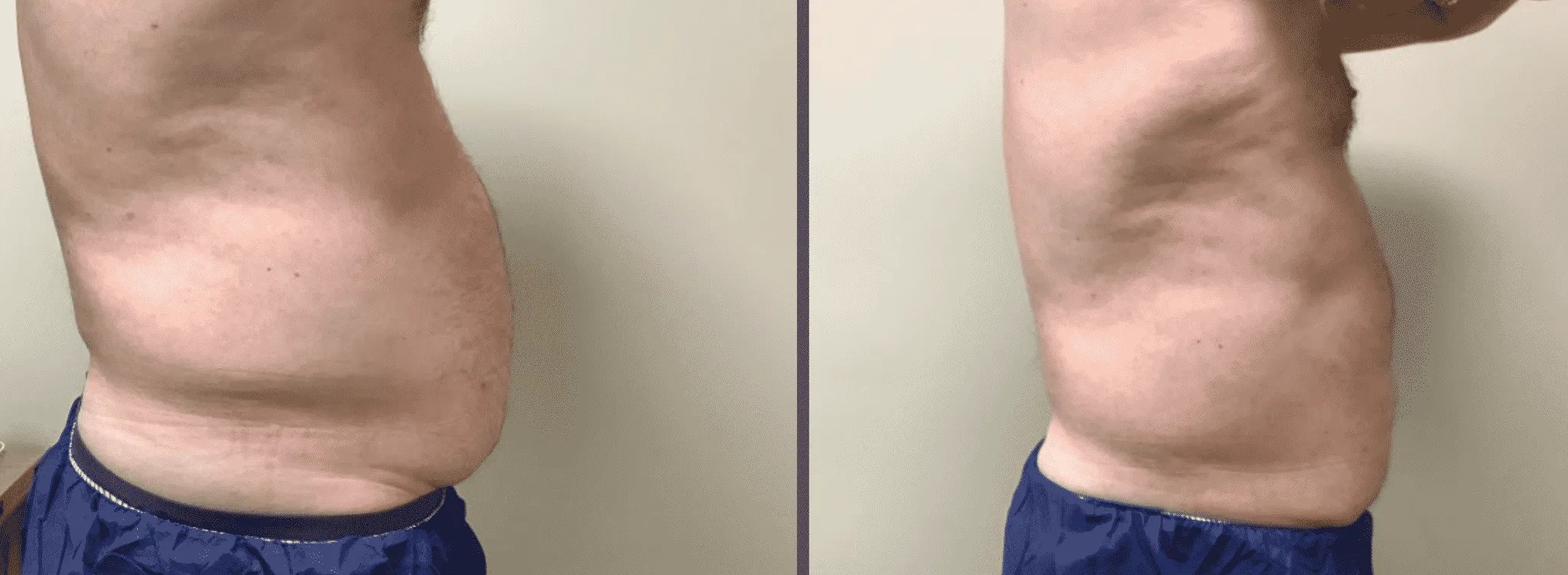 CoolSculpting® Skin Cancer & Cosmetic Surgery Center of NJ