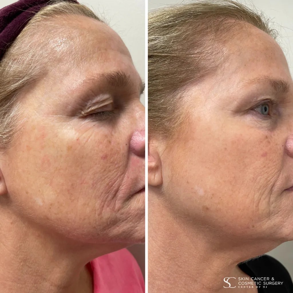 Cosmetic Dermatology NJ Comprehensive Care