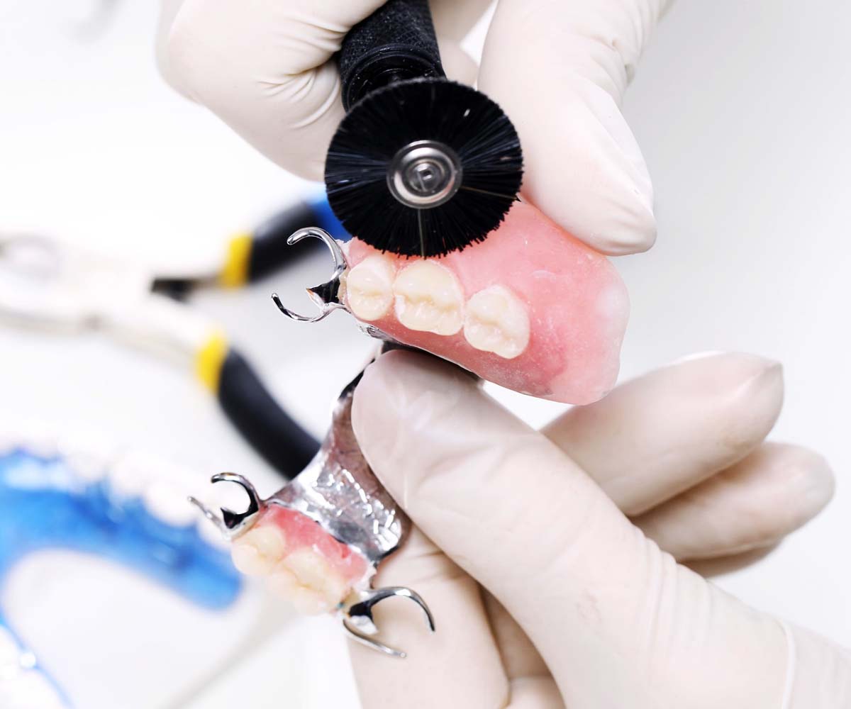 Denture Repairs - Edmonton South Centre Denture Clinic