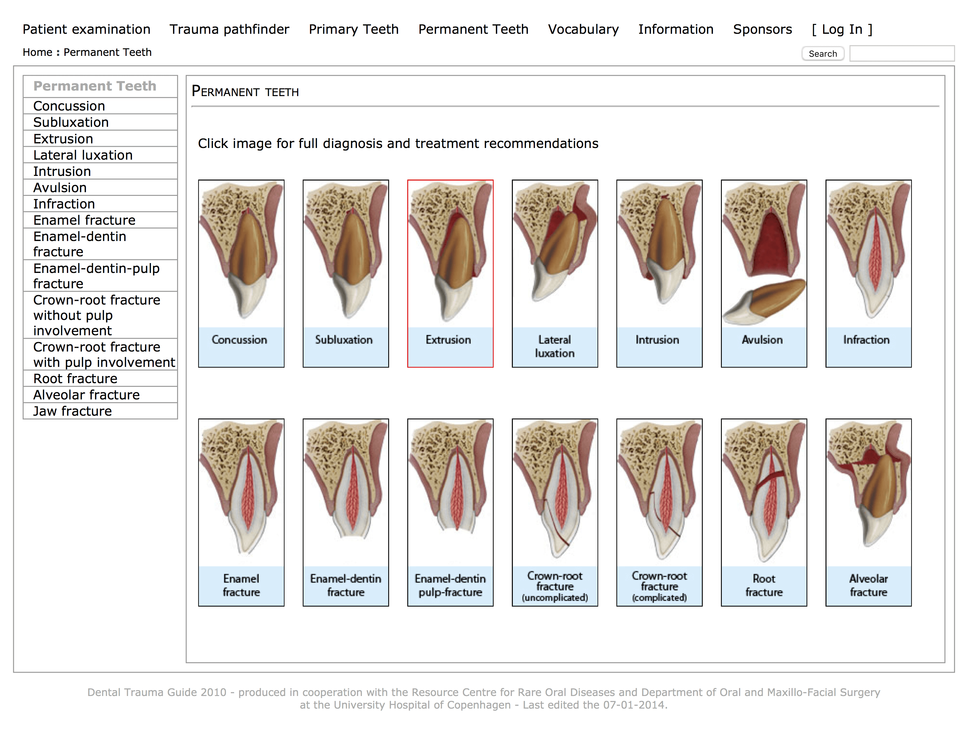 Dental Trauma Guide pic Charlie's ED