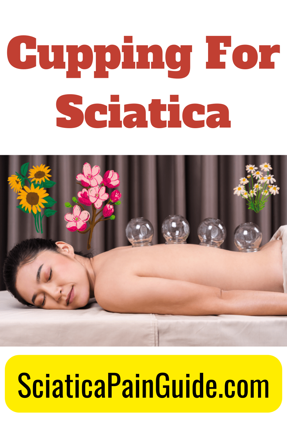 Cupping For Sciatica Sciatica Pain Guide
